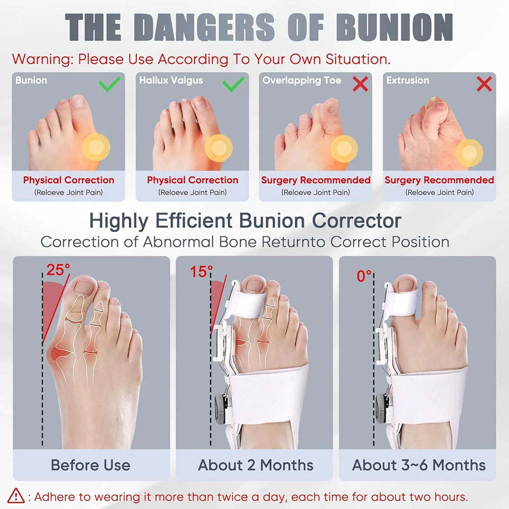 BuneeFix Bunion Corrector