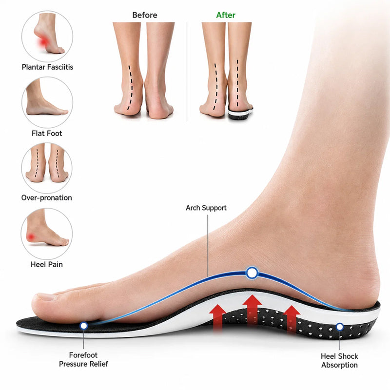 Stepioxa Orthopedic Insoles