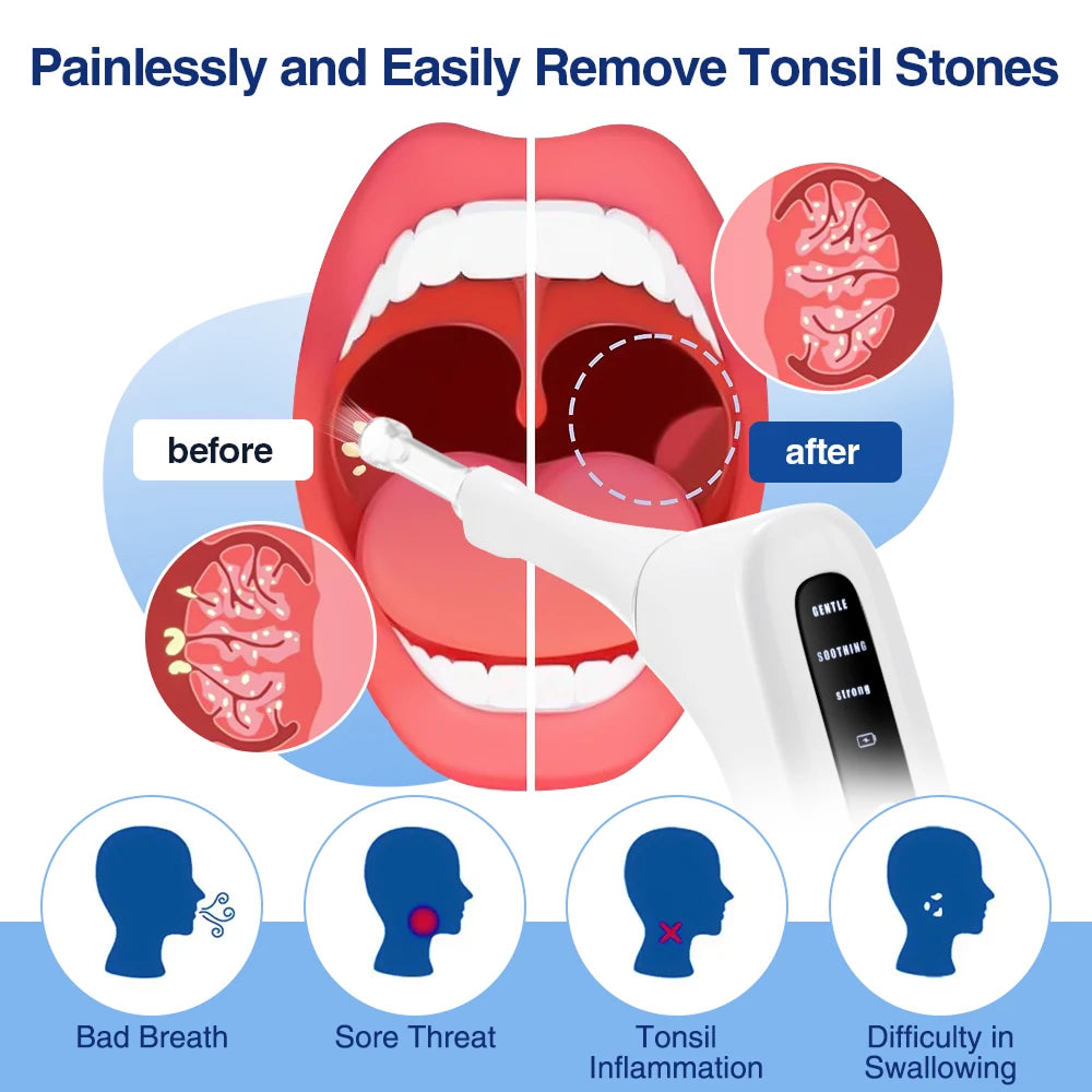 Tonsimox